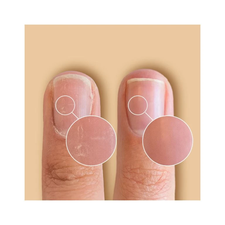 CND Solaroil Nail & Cuticle Treatment 2 CND Solaroil Nail & Cuticle Treatment - Billede 2